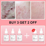 Collagen Peptide Facial Serum Targets Dull Skin Boosts Skin Elasticity Stimulates Skin Renewal Repair Salmon PDRN KOREAN Product - Luxelstore