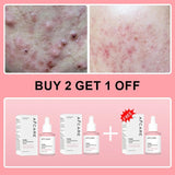 Collagen Peptide Facial Serum Targets Dull Skin Boosts Skin Elasticity Stimulates Skin Renewal Repair Salmon PDRN KOREAN Product - Luxelstore