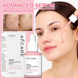 Collagen Peptide Facial Serum Targets Dull Skin Boosts Skin Elasticity Stimulates Skin Renewal Repair Salmon PDRN KOREAN Product - Luxelstore