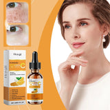 Hoygi 30ml Vitamin C Serum For Face Moisturizing Hydrating Facial Lightening Blemish Melanin Fine Lines Brightening Facial Serum - Luxelstore