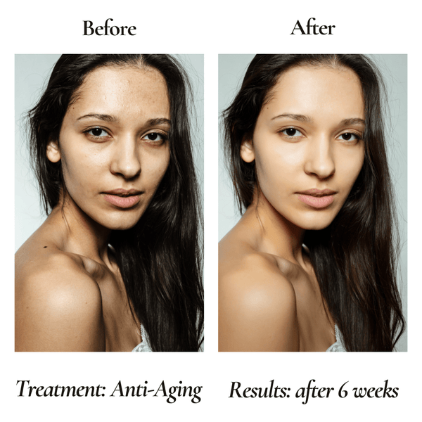 Anti - Aging Organic Facial Moisturizer - FOR WOMEN - Luxelstore