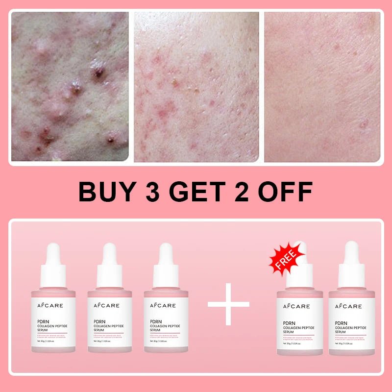 Collagen Peptide Facial Serum Targets Dull Skin Boosts Skin Elasticity Stimulates Skin Renewal Repair Salmon PDRN KOREAN Product - Luxelstore