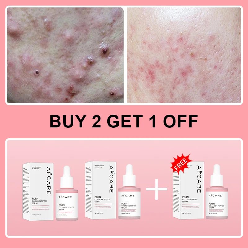 Collagen Peptide Facial Serum Targets Dull Skin Boosts Skin Elasticity Stimulates Skin Renewal Repair Salmon PDRN KOREAN Product - Luxelstore