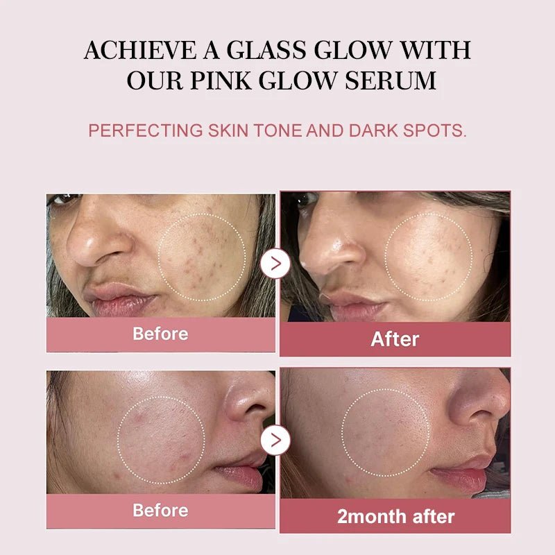Collagen Peptide Facial Serum Targets Dull Skin Boosts Skin Elasticity Stimulates Skin Renewal Repair Salmon PDRN KOREAN Product - Luxelstore