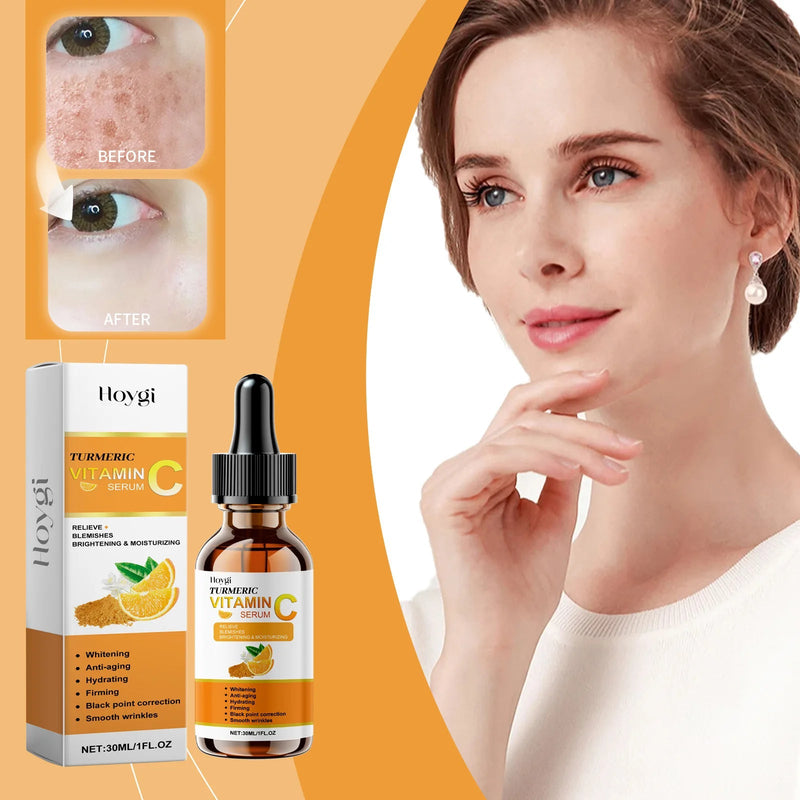Hoygi 30ml Vitamin C Serum For Face Moisturizing Hydrating Facial Lightening Blemish Melanin Fine Lines Brightening Facial Serum - Luxelstore